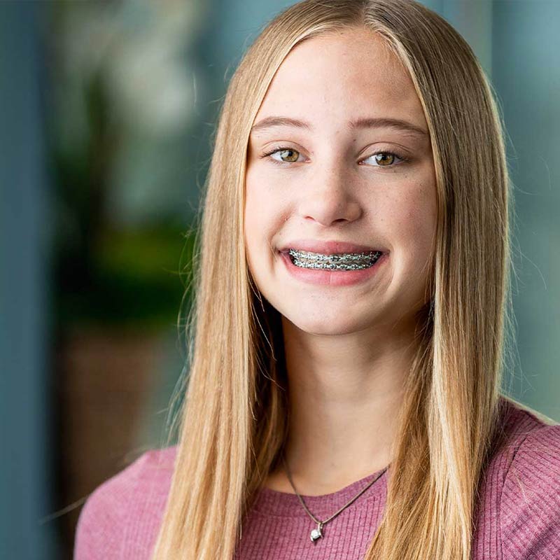 Early Orthodontics  Columbus Family Dental